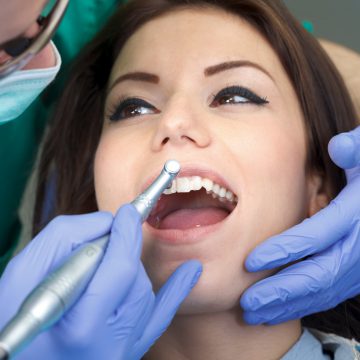 Picture of a professional dental brushing at the clinic
